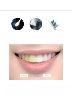 Sonic electric Toothbrush SG-551, white with 3 heads