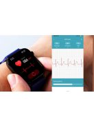 New AI Medical Diagnosis Blood Lipids Uric Acid Blood Glucose Smart Watch Men ECG+PPG Voice Bluetooth Call Health Smartwatch